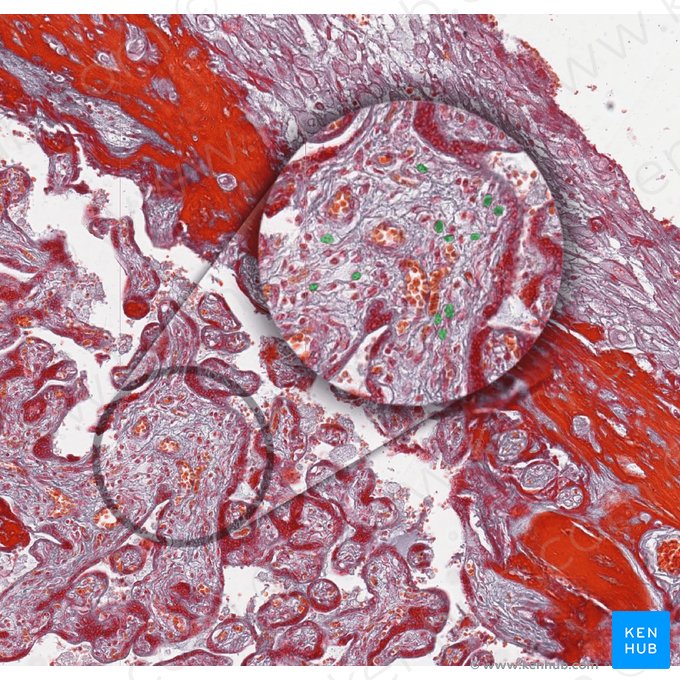 Hofbauer cells; Image: 