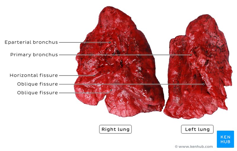 Some bronchi and fissures of the lungs