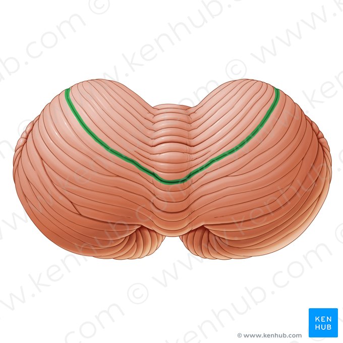 Primary fissure of cerebellum (Fissura prima cerebelli); Image: Paul Kim