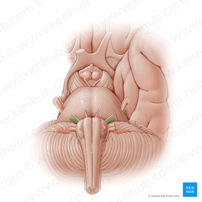Vestibulocochlear nerve (Nervus vestibulocochlearis); Image: Paul Kim