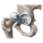 Articulation coxofémorale (hanche)