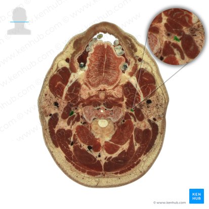 Vena jugularis interna (Innere Drosselvene); Bild: National Library of Medicine