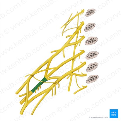 Fasciculus posterior plexus brachialis (Hinteres Bündel des Armgeflechts); Bild: Begoña Rodriguez