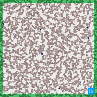 Blood smear (Sanguis); Image: 