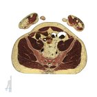 Cross sections of the upper extremity: Wrist and hand level