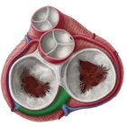 Coronary sinus