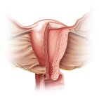 Uterus