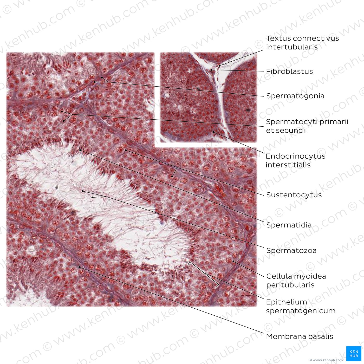 Hoden (histologisches Präparat; hohe Vergrößerung; Färbung: Ladewig)
