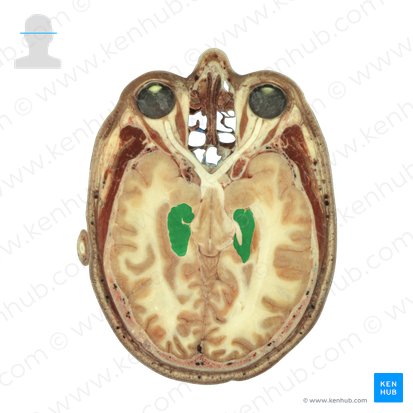 Hipocampo (Hippocampus); Imagen: National Library of Medicine