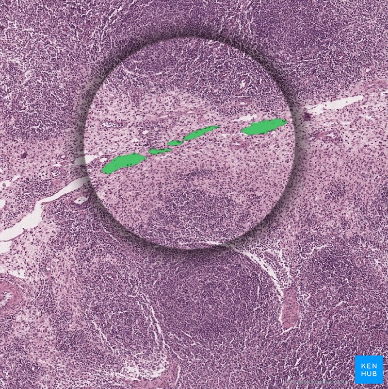 Medullary sinuses - histological slide