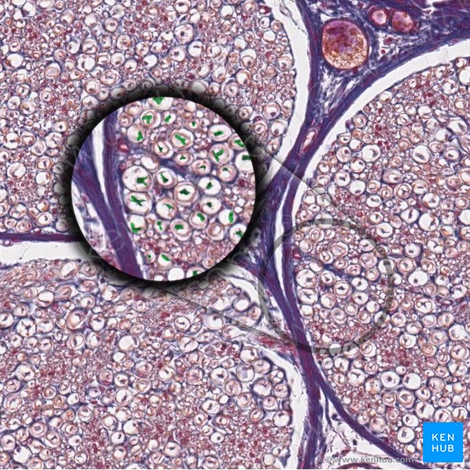Axônio periférico mielínico (Axon myelinatum periphericum); Imagem: 