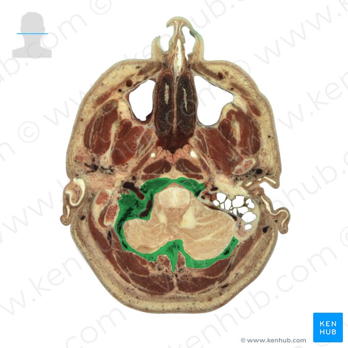 Os occipitale (Hinterhauptbein); Bild: National Library of Medicine