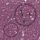 Cytoarchitecture of cerebral cortex