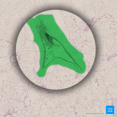 Arteria pulmonalis (Lungenarterie); Bild: 