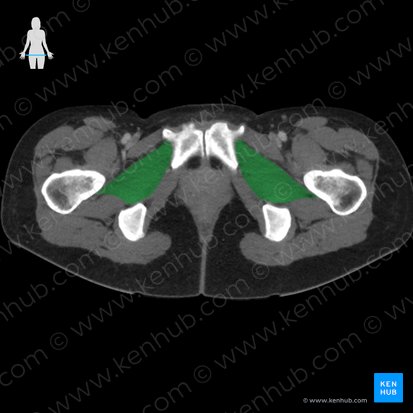 Musculus obturatorius externus (Äußerer Hüftlochmuskel); Bild: 