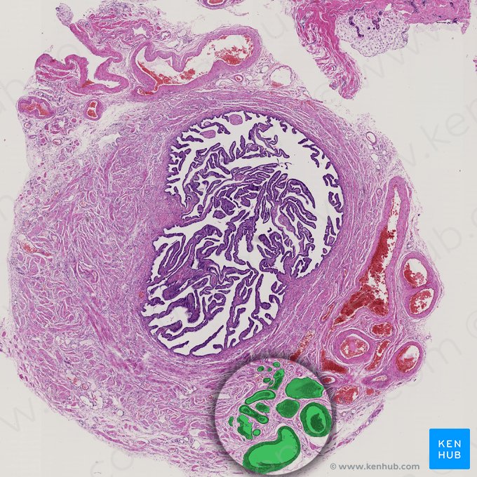 Ramas de las venas ováricas y uterinas (Rami venarum utericae et ovaricae); Imagen: 