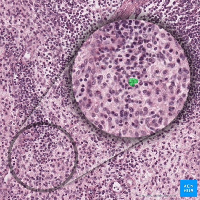 Macrophage (Macrophagocytus); Image: 