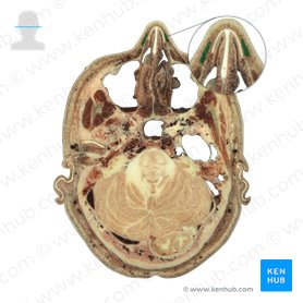 Nasalis muscle (Musculus nasalis); Image: National Library of Medicine