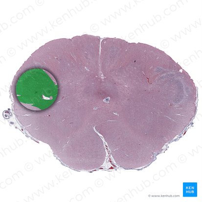 Nucleus spinalis nervi trigemini (Wirbelsäulenkern des Drillingsnervs); Bild: 