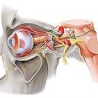 Trochlear nerve (cranial nerve IV) 