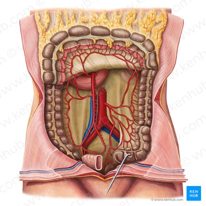 Arteria caecalis anterior (Vordere Blinddarmarterie); Bild: Irina Münstermann