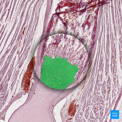 Placa epifisiaria (Lamina epiphysialis); Imagen: 