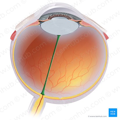 Canalis hyaloideus (Glaskörperkanal); Bild: Paul Kim