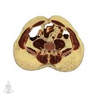 4th lumbar vertebra level