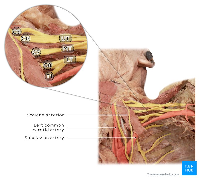 Brachial plexus - Dissection image