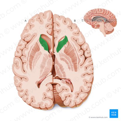 Cabeza del núcleo caudado (Caput nuclei caudati); Imagen: Paul Kim
