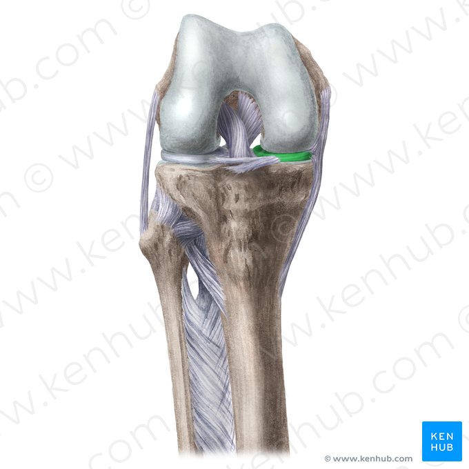 Menisco medial (Meniscus medialis); Imagem: Liene Znotina