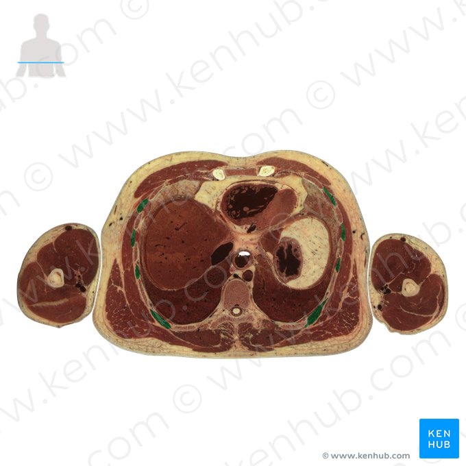 Musculi intercostales externi (Äußere Zwischenrippenmuskeln); Bild: National Library of Medicine