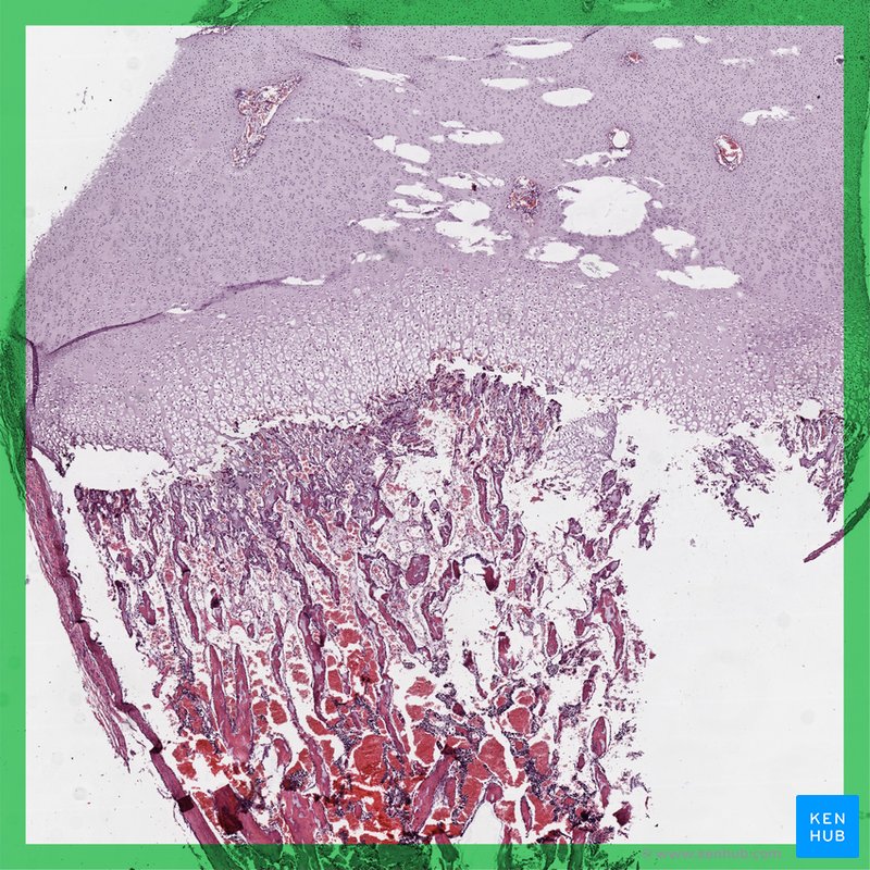 Endochondral ossification - histological slide