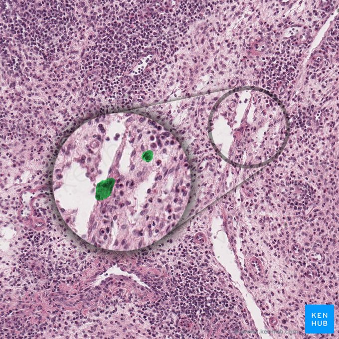 Macrophage (Macrophagocytus); Image : 