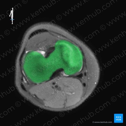 Tibia; Image : 