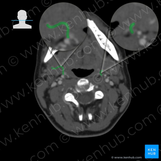 Facial artery (Arteria facialis); Image: 