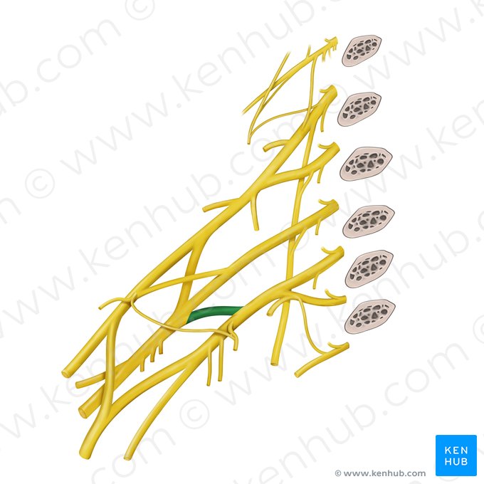 División posterior del tronco inferior del plexo braquial (Divisio posterior trunci inferior plexus brachialis); Imagen: Begoña Rodriguez