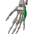 Abductor digiti minimi muscle of hand