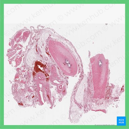 Spermatic cord (Funiculus spermaticus); Image: 