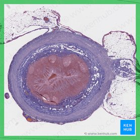 Appendix vermiformis (Wurmfortsatz); Bild: 