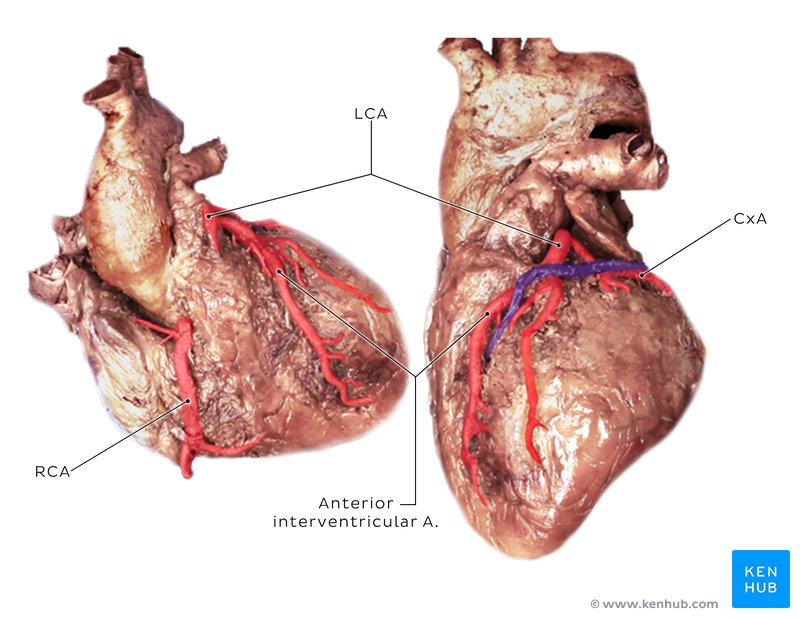 Cadaver image of the coronary arteries - anterior view