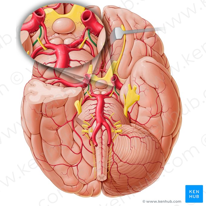 Arteria choroidea anterior (Vordere Aderhautarterie); Bild: Paul Kim