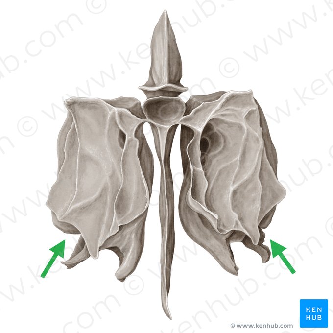 Infundíbulo etmoidal (Infundibulum ethmoidale); Imagen: Samantha Zimmerman