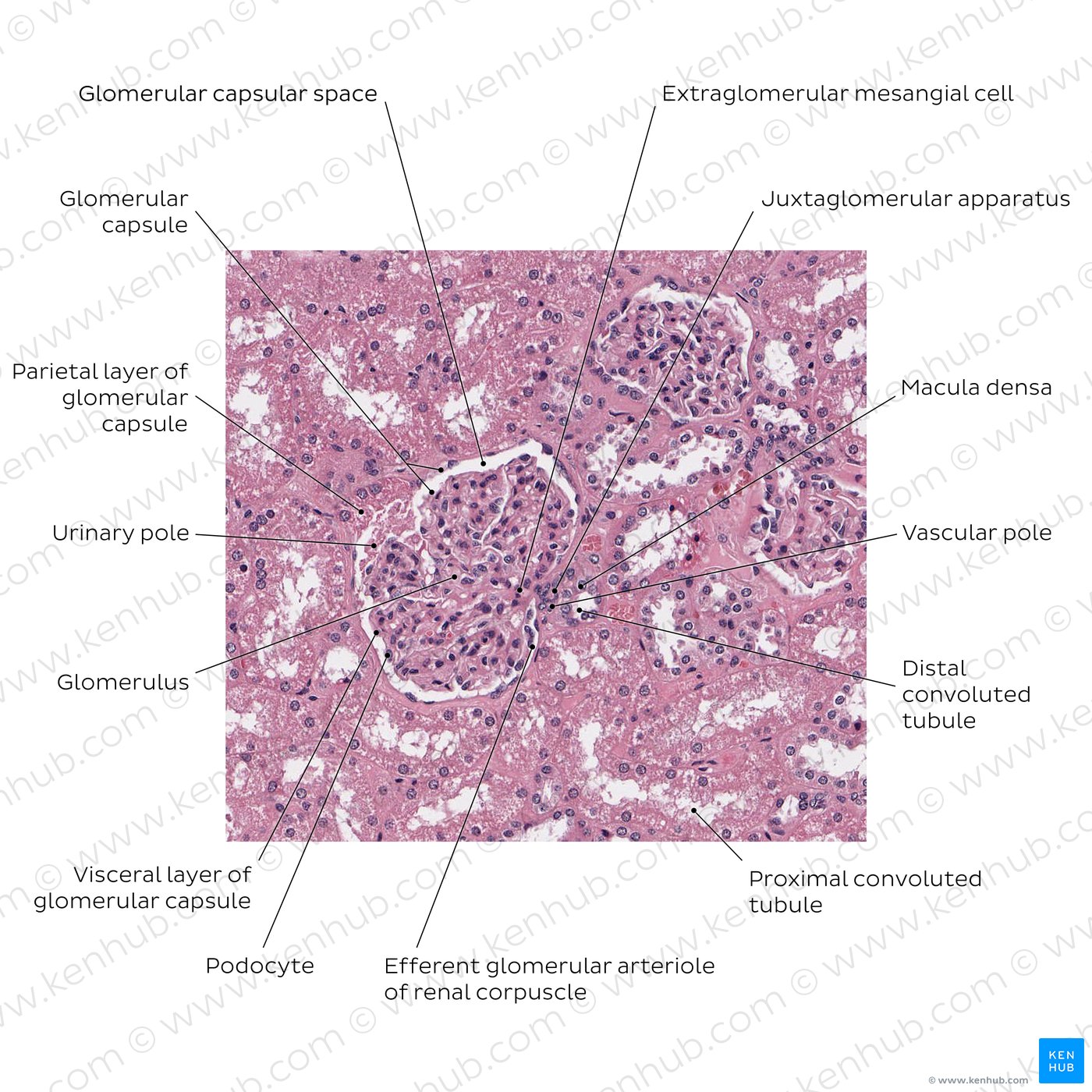 Kidney (renal corpuscle)