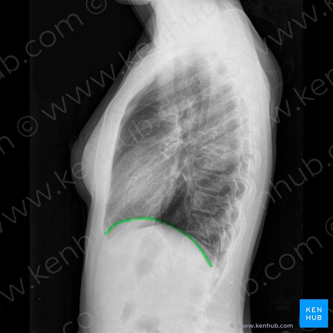 Hemidiafragma derecho (Hemidiaphragma dexter); Imagen: 