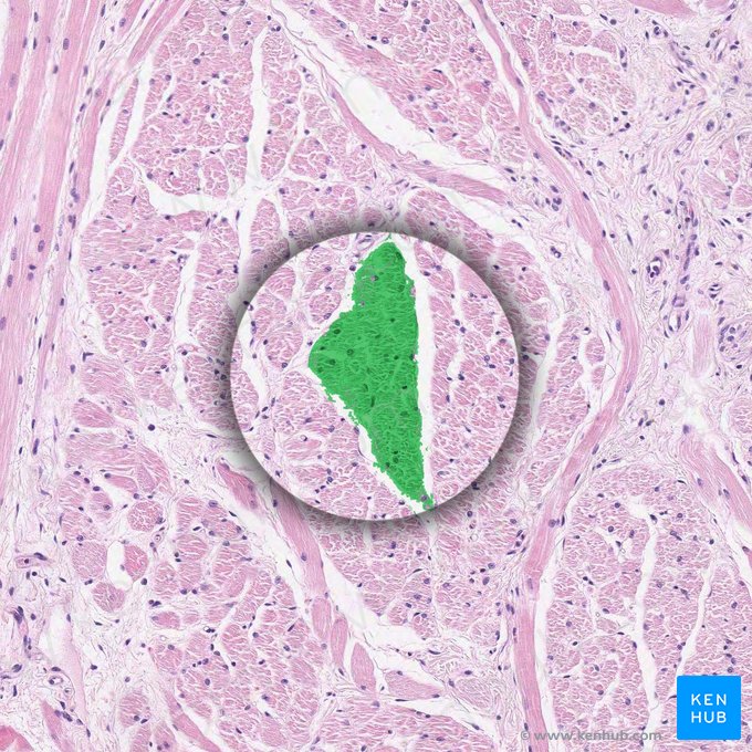 Fascículo muscular (Fasciculus muscularis); Imagen: 