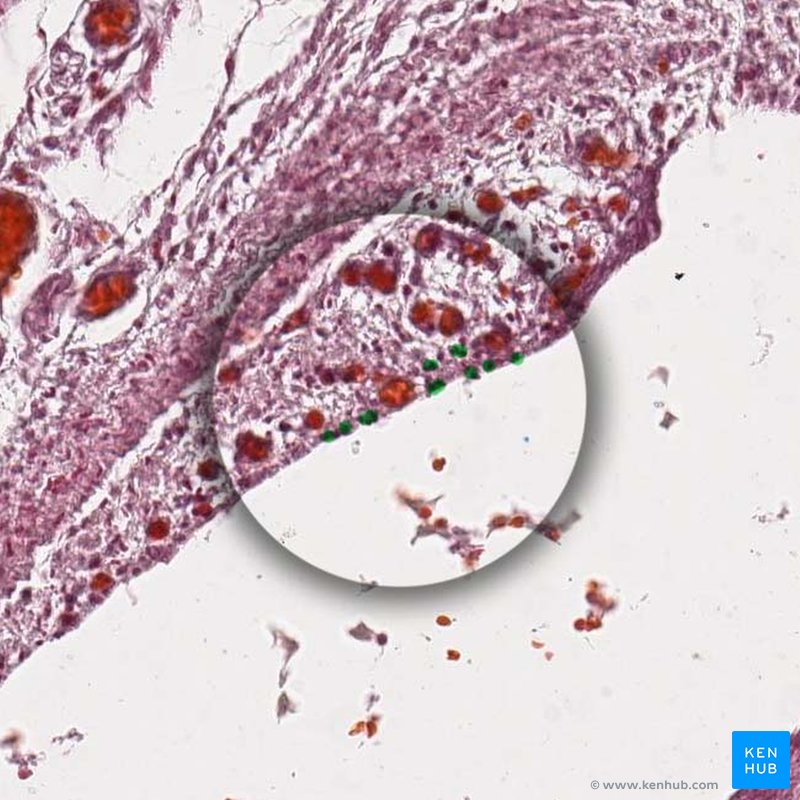 Synovial cells - histological slide