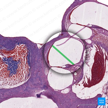 Vestibular membrane of cochlear duct (Membrana vestibularis ductus cochlearis); Image: 