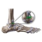 Ligamentum talofibulare anterius