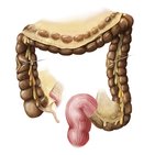 Large intestine